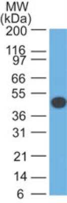 Western Blot: Cytokeratin 18 Antibody (DA7) [NBP2-29409]