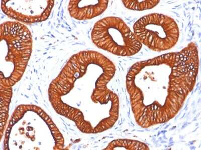 Immunohistochemistry-Paraffin: Cytokeratin 18 Antibody (DC10) - Azide and BSA Free [NBP2-33082]