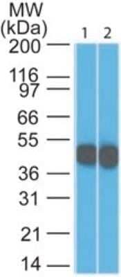 Western Blot: Cytokeratin 18 Antibody (DC10) [NBP2-29461]
