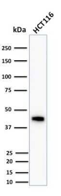 Western Blot: Cytokeratin 18 Antibody (DC10) [NBP2-29461]