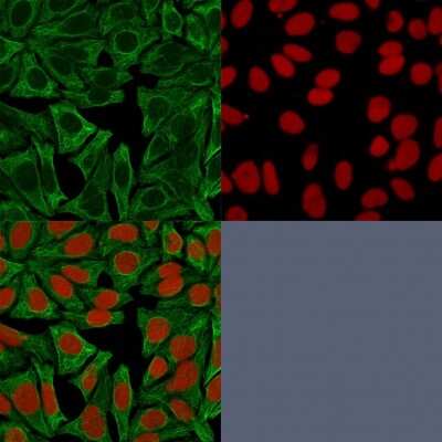 Immunocytochemistry/ Immunofluorescence: Cytokeratin 18 Antibody (DE-K18) [NBP2-44947]