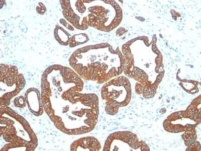 Immunohistochemistry-Paraffin: Cytokeratin 18 Antibody (DE-K18) [NBP2-44947]