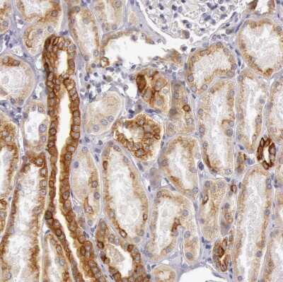 Immunohistochemistry-Paraffin: Cytokeratin 18 Antibody [NBP1-90353]