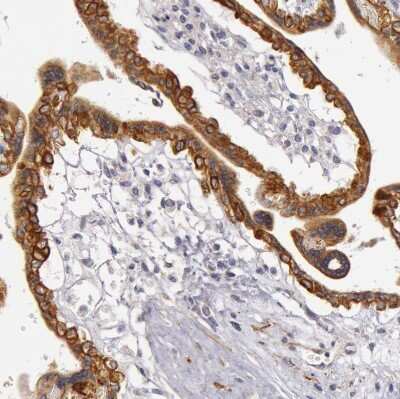 Immunohistochemistry-Paraffin: Cytokeratin 18 Antibody [NBP1-90353]