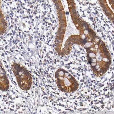 Immunohistochemistry-Paraffin: Cytokeratin 18 Antibody [NBP1-90353]