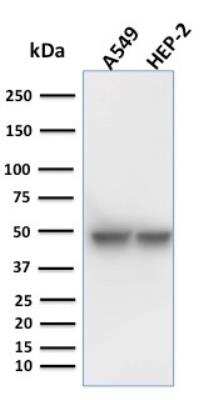 Western Blot: Cytokeratin 18 Antibody (KRT18/1190)Azide and BSA Free [NBP2-47984]