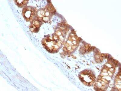 Immunohistochemistry-Paraffin: Cytokeratin 18 Antibody (KRT18/1190) - IHC-Prediluted [NBP2-48048]