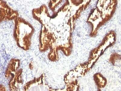 Immunohistochemistry-Paraffin: Cytokeratin 18 Antibody (KRT18/1190) [NBP2-44942]