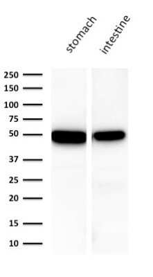 Western Blot: Cytokeratin 18 Antibody (KRT18/1190) [NBP2-44942]