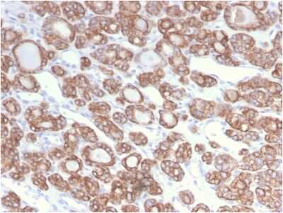 Immunohistochemistry-Paraffin: Cytokeratin 18 Antibody (KRT18/2808R) [NBP3-07692]