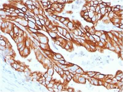 Immunohistochemistry-Paraffin: Cytokeratin 18 Antibody (KRT18/2808R) [NBP3-07692]