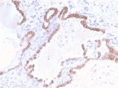 Immunohistochemistry-Paraffin: Cytokeratin 18 Antibody (KRT18/2808R) [NBP3-07692]