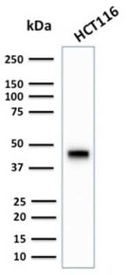 Western Blot: Cytokeratin 18 Antibody (KRT18/2808R) [NBP3-07692]