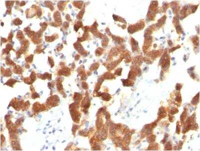 Immunohistochemistry-Paraffin: Cytokeratin 18 Antibody (KRT18/834) - Azide and BSA Free [NBP2-47985]