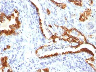 Immunohistochemistry-Paraffin: Cytokeratin 18 Antibody (KRT18/834) - Azide and BSA Free [NBP2-47985]