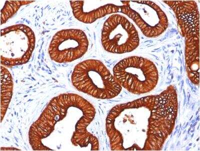 Immunohistochemistry-Paraffin: Cytokeratin 18 Antibody (KRT18/834) - Azide and BSA Free [NBP2-47985]