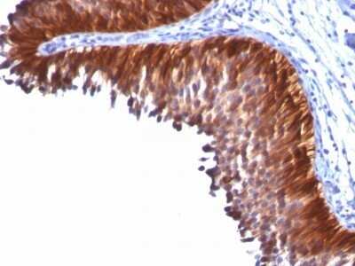 Immunohistochemistry-Paraffin: Cytokeratin 18 Antibody (KRT18/834) - Azide and BSA Free [NBP2-47985]