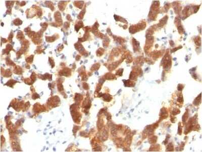 Immunohistochemistry-Paraffin: Cytokeratin 18 Antibody (KRT18/834) - IHC-Prediluted [NBP2-48056]