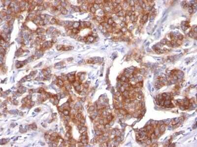 Immunohistochemistry-Paraffin: Cytokeratin 18 Antibody (KRT18/834) - IHC-Prediluted [NBP2-48056]