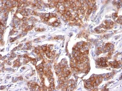 Immunohistochemistry-Paraffin: Cytokeratin 18 Antibody (KRT18/834) [NBP2-44948]