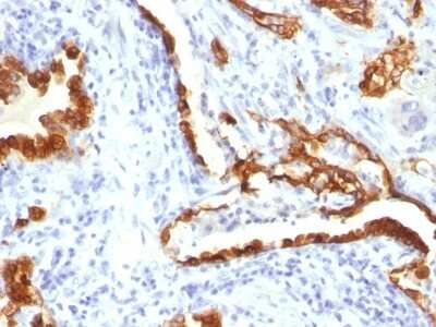Immunohistochemistry-Paraffin: Cytokeratin 18 Antibody (KRT18/834) [NBP2-44948]