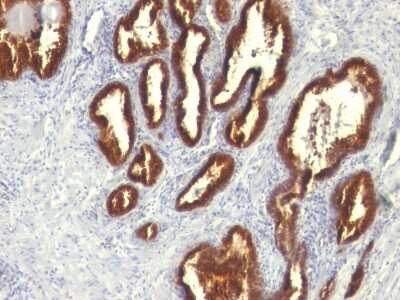 Immunohistochemistry-Paraffin: Cytokeratin 18 Antibody (KRT18/834) [NBP2-44948]