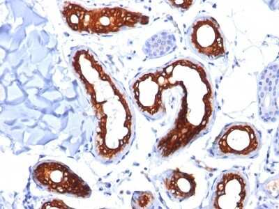 Immunohistochemistry-Paraffin: Cytokeratin 18 Antibody (KRT18/834) [NBP2-44948]