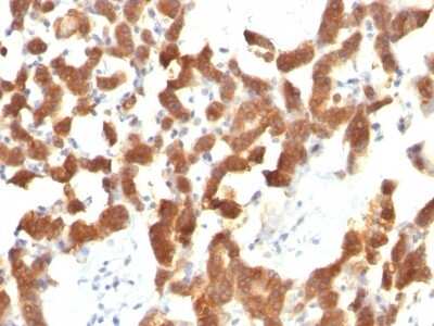 Immunohistochemistry-Paraffin: Cytokeratin 18 Antibody (KRT18/834) [NBP2-44948]