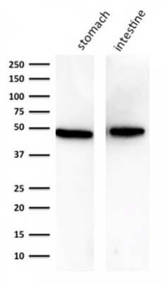 Western Blot: Cytokeratin 18 Antibody (KRT18/834) [NBP2-44948]
