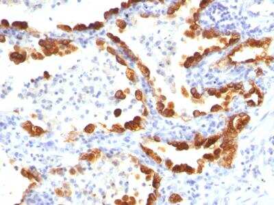 Immunohistochemistry-Paraffin: Cytokeratin 18 Antibody (KRT18/835) - Azide and BSA Free [NBP2-47986]