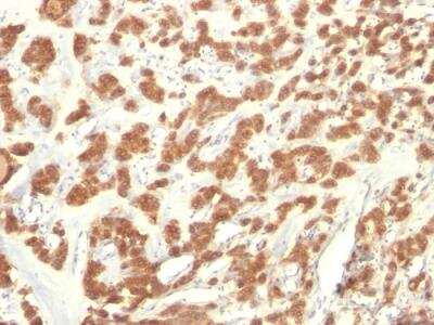 Immunohistochemistry-Paraffin: Cytokeratin 18 Antibody (KRT18/835) - Azide and BSA Free [NBP2-47986]
