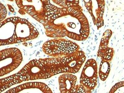 Immunohistochemistry-Paraffin: Cytokeratin 18 Antibody (KRT18/835) - Azide and BSA Free [NBP2-47986]