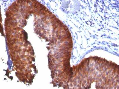 Immunohistochemistry-Paraffin: Cytokeratin 18 Antibody (KRT18/835) - Azide and BSA Free [NBP2-47986]