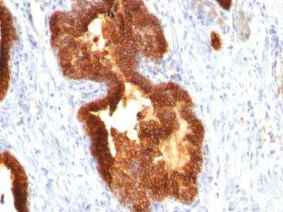Immunohistochemistry-Paraffin: Cytokeratin 18 Antibody (KRT18/835) - Azide and BSA Free [NBP2-47986]
