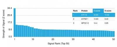Protein Array: Cytokeratin 18 Antibody (KRT18/835) [NBP2-44949]