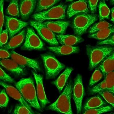 Immunocytochemistry/ Immunofluorescence: Cytokeratin 18 Antibody (KRT18/836) [NBP2-44950]