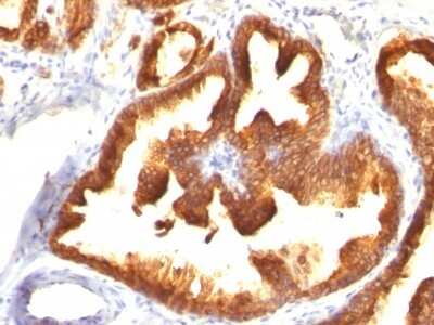 Immunohistochemistry-Paraffin: Cytokeratin 18 Antibody (KRT18/836) [NBP2-44950]