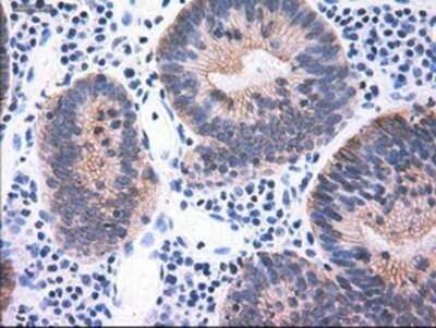 Immunohistochemistry: Cytokeratin 18 Antibody (OTI1E1) - Azide and BSA Free [NBP2-71086]