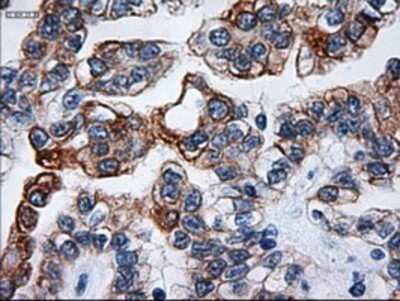 Immunohistochemistry: Cytokeratin 18 Antibody (OTI1E1) - Azide and BSA Free [NBP2-71086]