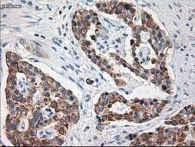 Immunohistochemistry: Cytokeratin 18 Antibody (OTI1E1) - Azide and BSA Free [NBP2-71086]