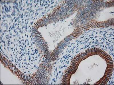 Immunohistochemistry: Cytokeratin 18 Antibody (OTI1E1) - Azide and BSA Free [NBP2-71086]