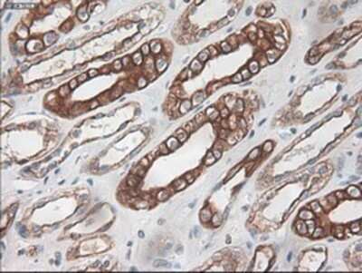 Immunohistochemistry: Cytokeratin 18 Antibody (OTI1E1) - Azide and BSA Free [NBP2-71086]