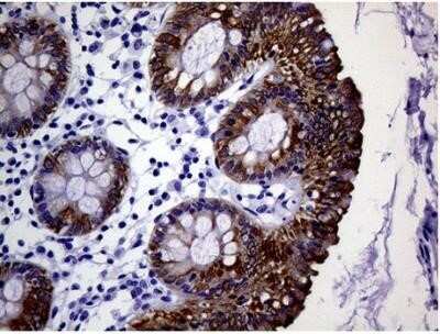 Immunohistochemistry: Cytokeratin 18 Antibody (OTI1E1) - Azide and BSA Free [NBP2-71086]