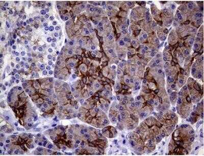 Immunohistochemistry: Cytokeratin 18 Antibody (OTI1E1) - Azide and BSA Free [NBP2-71086]