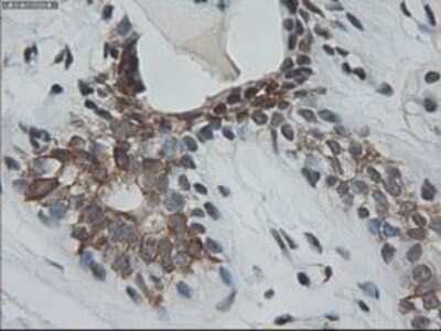 Immunohistochemistry-Paraffin: Cytokeratin 18 Antibody (OTI1E1) [NBP1-47817]