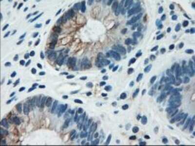 Immunohistochemistry-Paraffin: Cytokeratin 18 Antibody (OTI1E1) [NBP1-47817]
