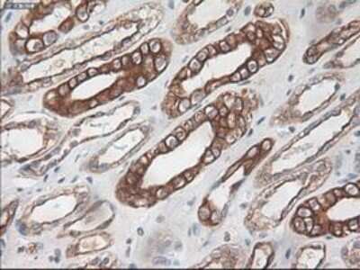 Immunohistochemistry-Paraffin: Cytokeratin 18 Antibody (OTI1E1) [NBP1-47817]