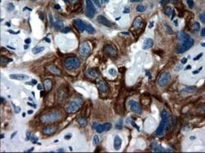Immunohistochemistry-Paraffin: Cytokeratin 18 Antibody (OTI1E1) [NBP1-47817]
