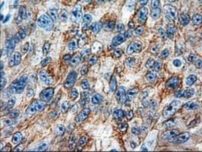 Immunohistochemistry-Paraffin: Cytokeratin 18 Antibody (OTI1E1) [NBP1-47817]
