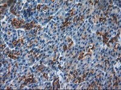 Immunohistochemistry-Paraffin: Cytokeratin 18 Antibody (OTI1E1) [NBP1-47817]